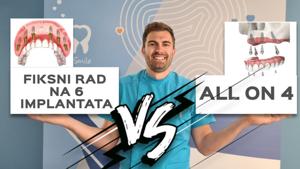 VLOG-FIKSNI-RAD-VS-ALL-ON-4-e1623842880309