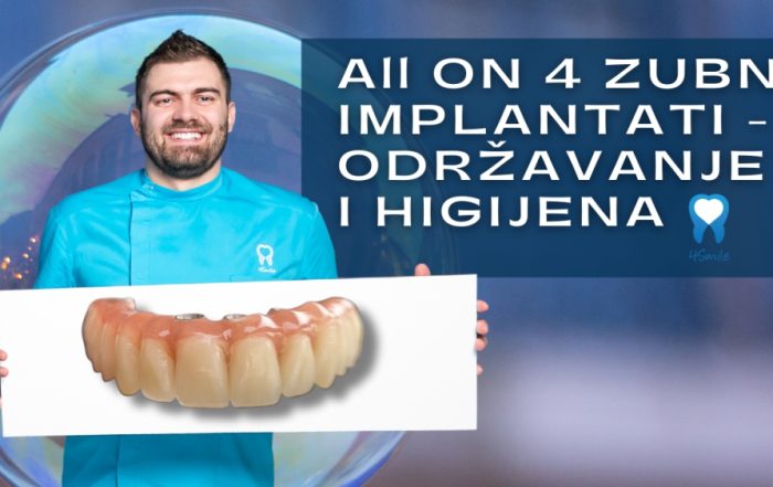 all-on-4-zubni-implantati-odrzavanje-i-higijena-video-blog