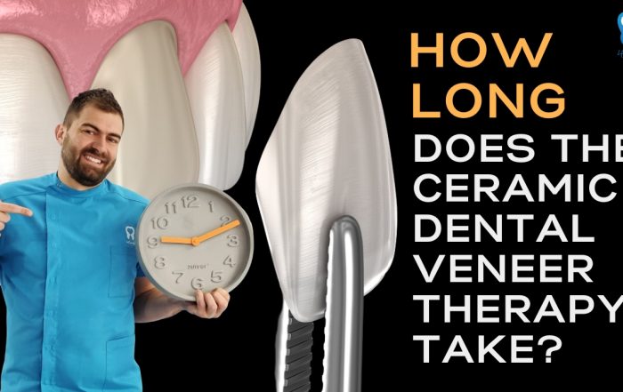 how-long-does-the-ceramic-dental-veneer-therapy-take