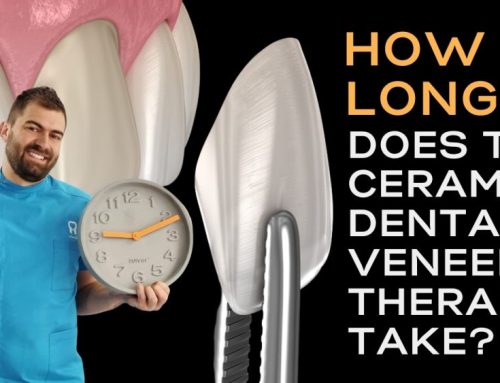 How long does the ceramic dental veneer therapy take?
