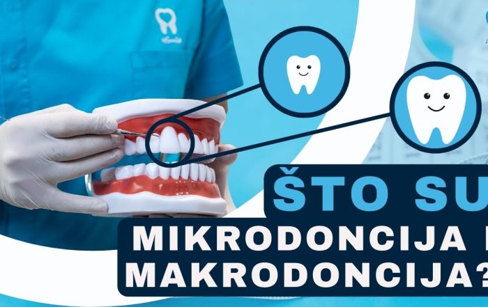 mikrodoncija-i-makrodoncija-preveliki-i-premaleni-zubi