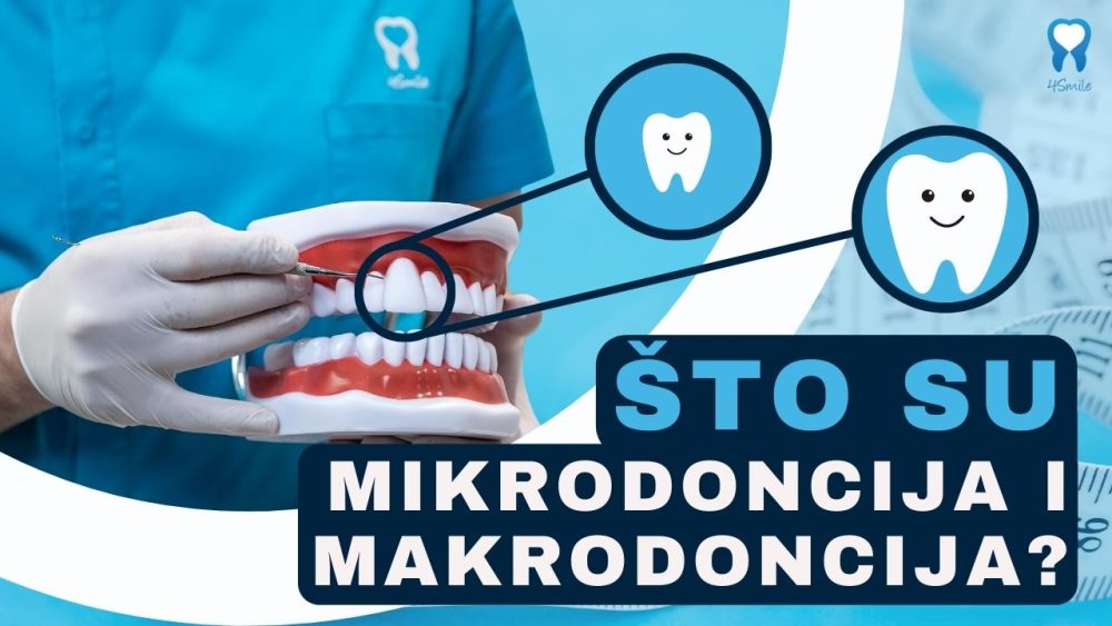 mikrodoncija-i-makrodoncija-preveliki-i-premaleni-zubi mikrodoncija-i-makrodoncija-preveliki-i-premaleni-zubi