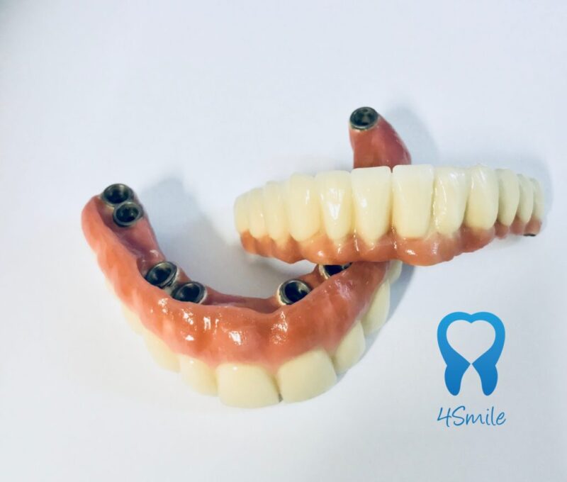 Dental ceramic bridge with 6 implants outside the mouth - 4Smile