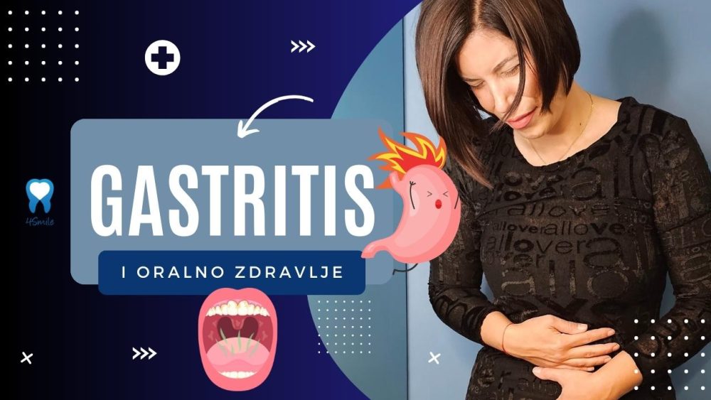 kako-gastritis-moze-utjecati-na-oralno-zdravlje kako-gastritis-moze-utjecati-na-oralno-zdravlje