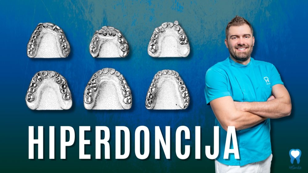 hiperdoncija-je-li-moguce-imati-prirodni-visak-zuba-u-ustima hiperdoncija-je-li-moguce-imati-prirodni-visak-zuba-u-ustima