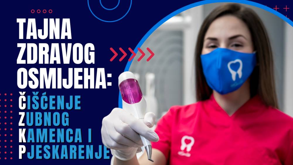 tajna-zdravog-osmijeha-redovito-ciscenje-zubnog-kamenca-i-pjeskarenje tajna-zdravog-osmijeha-redovito-ciscenje-zubnog-kamenca-i-pjeskarenje