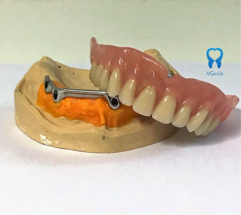 Zubna proteza