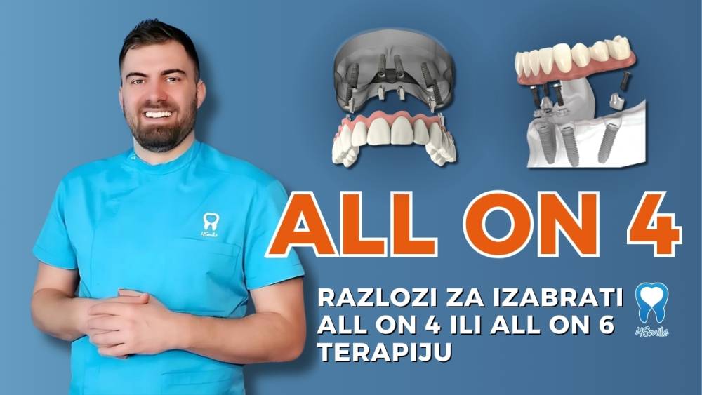 all-on-4-razlozi-za-izabrati-all-on-4-ili-all-on-6-terapiju all-on-4-razlozi-za-izabrati-all-on-4-ili-all-on-6-terapiju
