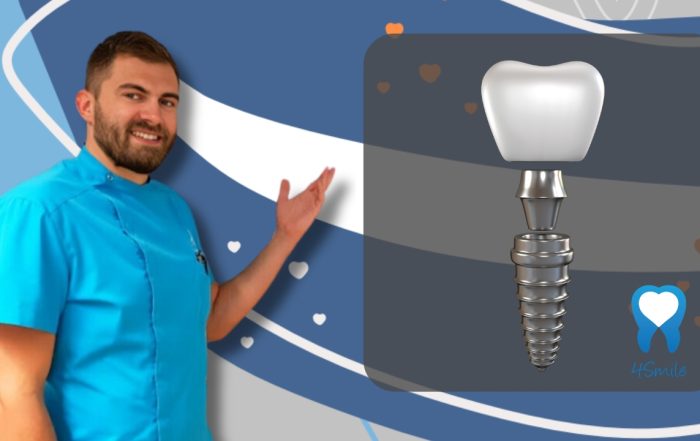 what-does-a-complete-dental-implant-consist-of
