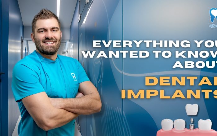 everything-you-wanted-to-know-about-dental-implants