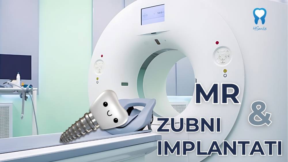 magnetna-rezonanca-i-zubni-implantati-je-li-sigurno magnetna-rezonanca-i-zubni-implantati-je-li-sigurno