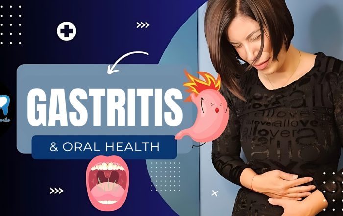 how-can-gastritis-affect-oral-health