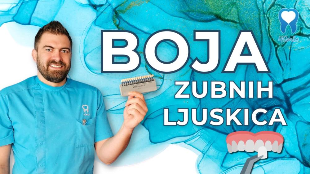 kako-odabrati-boju-zubnih-ljuskica-i-krunica-video-blog kako-odabrati-boju-zubnih-ljuskica-i-krunica-video-blog