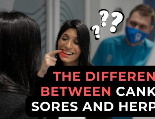 The difference between canker sores and herpes