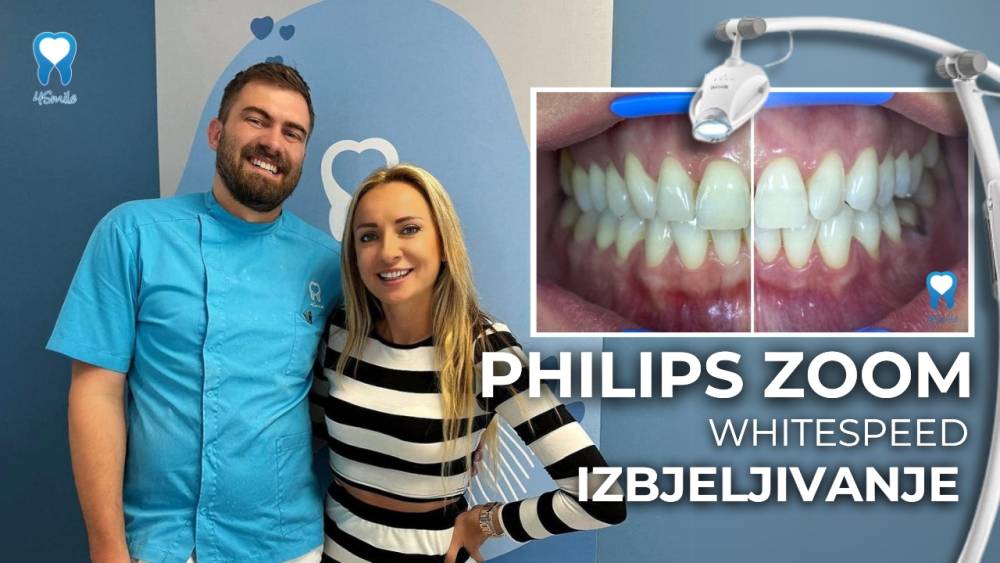 philips-zoom-izbjeljivanje-zuba-kratki-video-blog philips-zoom-izbjeljivanje-zuba-kratki-video-blog