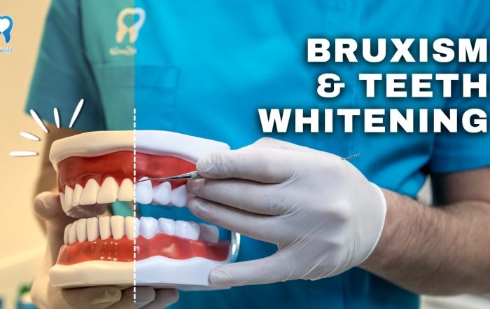 can-people-who-suffer-from-bruxism-whiten-their-teeth