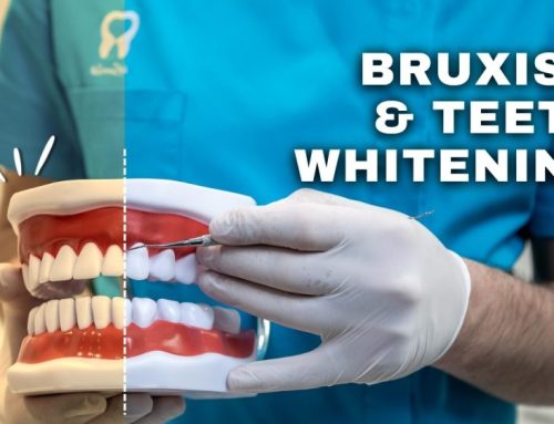 Can people who suffer from bruxism whiten their teeth?