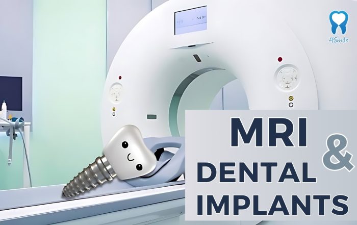 magnetic-resonance-imaging-and-dental-implants-is-it-safe