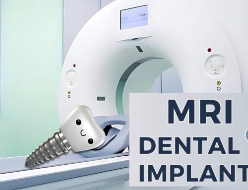 Magnetic Resonance Imaging and Dental Implants – Is It Safe?