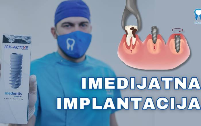 imedijatna-implantacija-video-blog