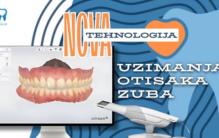 nova-tehnologija-uzimanja-otisaka-zuba-u-dental-centru-4smile