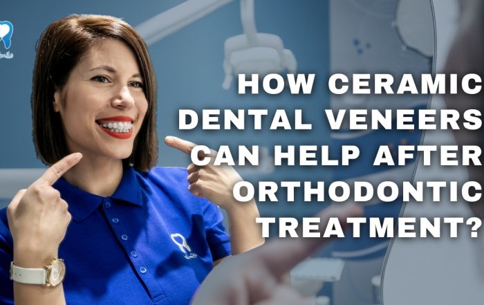 how-ceramic-dental-veneers-can-help-after-orthodontic-treatment