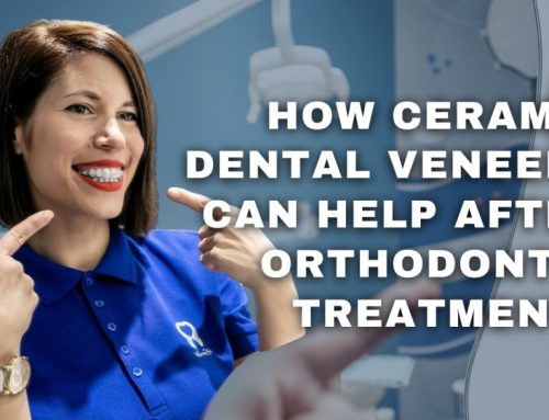 How ceramic dental veneers can help after orthodontic treatment?