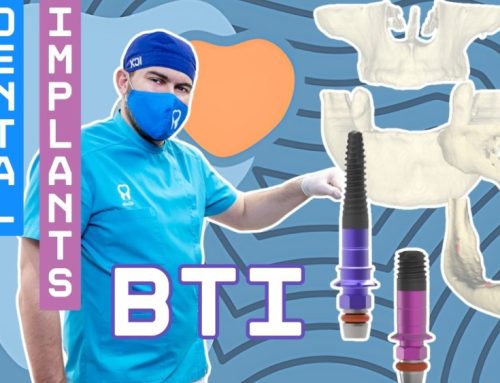 BTI mini dental implants – How to restore a smile in cases of severe bone resorption