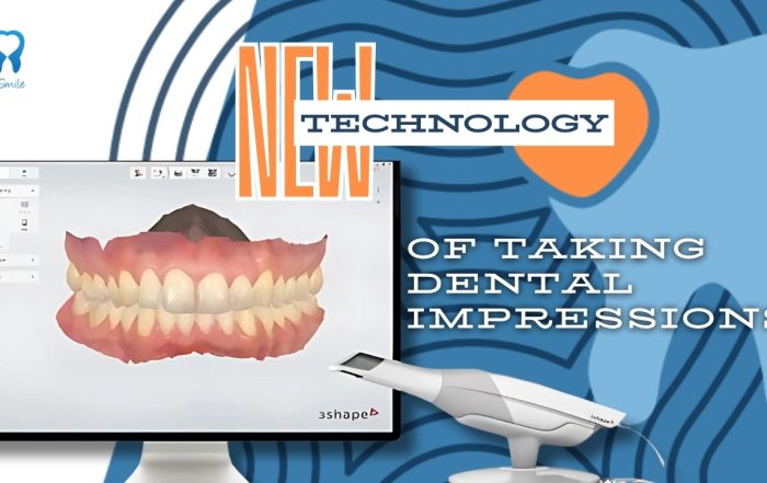 new-dental-impression-technology-at-dental-center-4smile