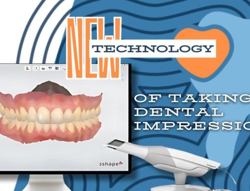 New dental impression technology at Dental Center 4Smile