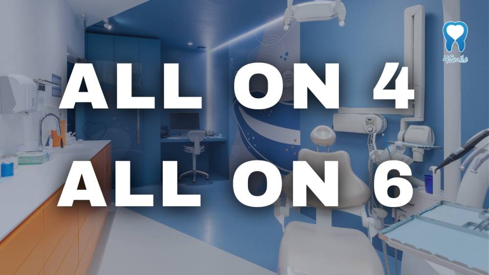 all-on-4-i-all-on-6-terapija-u-dental-centru-4smile-video-blog all-on-4-i-all-on-6-terapija-u-dental-centru-4smile-video-blog