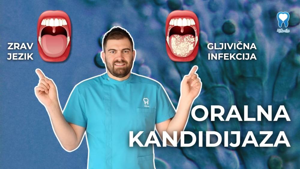 kandidijaza-sto-trebate-znati-o-ovoj-cestoj-gljivicnoj-infekciji kandidijaza-sto-trebate-znati-o-ovoj-cestoj-gljivicnoj-infekciji