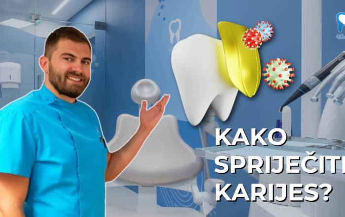 kako-sprijeciti-karijes