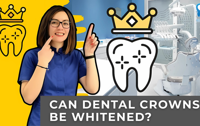 can-dental-crowns-be-whitened