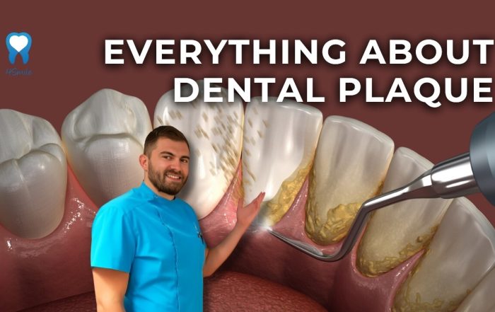 why-do-some-people-have-more-dental-plaque-and-tartar