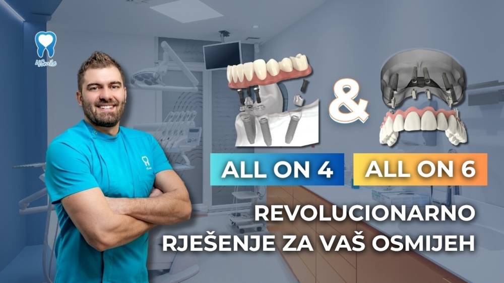 revolucionarno-rjesenje-za-vas-osmijeh-all-on-4-i-all-on-6-terapije-u-dental-centru-4smile revolucionarno-rjesenje-za-vas-osmijeh-all-on-4-i-all-on-6-terapije-u-dental-centru-4smile