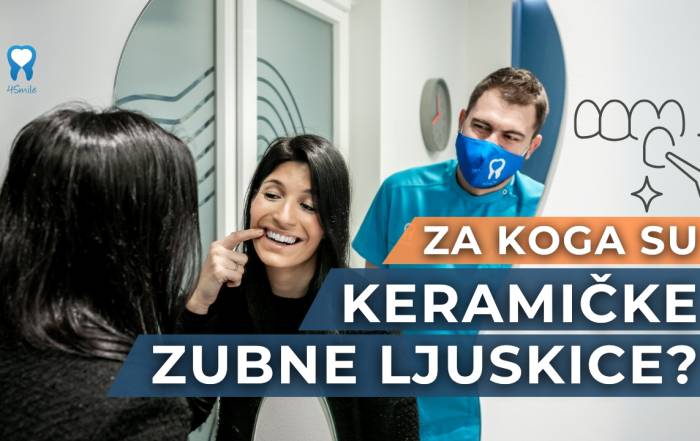 za-koga-su-keramicke-zubne-ljuskice