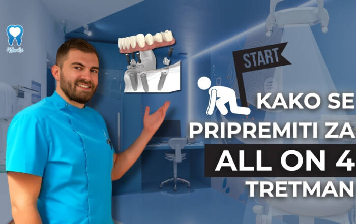 kako-se-pripremiti-za-all-on-4-tretman-video-blog