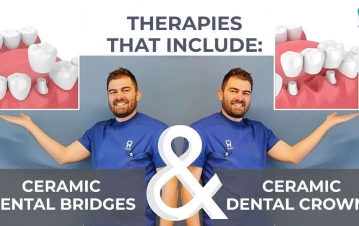 therapies-that-include-dental-bridges-and-ceramic-dental-crowns