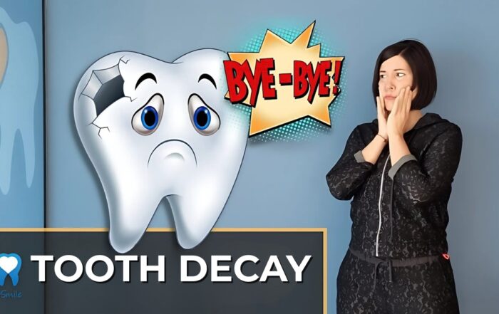 tooth-decay-and-how-to-prevent-it