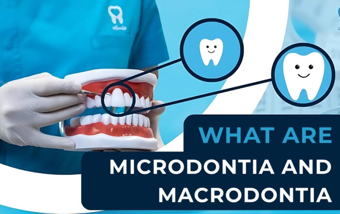 microdontia-and-macrodontia-oversized-and-undersized-teeth