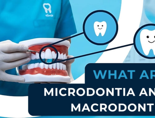 Microdontia and macrodontia – Oversized and undersized teeth