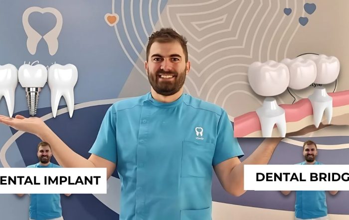 how-to-replace-one-tooth-dental-implant-or-dental-bridge