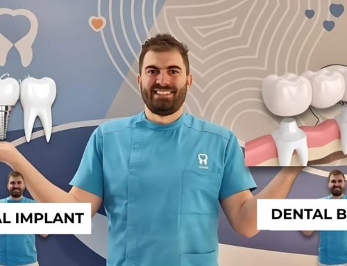 How to replace one tooth – Dental implant or dental bridge?