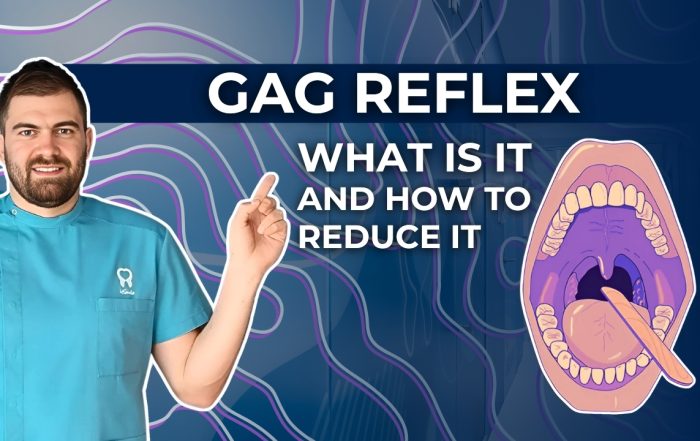 gag-reflex-what-it-is-and-how-to-reduce-it