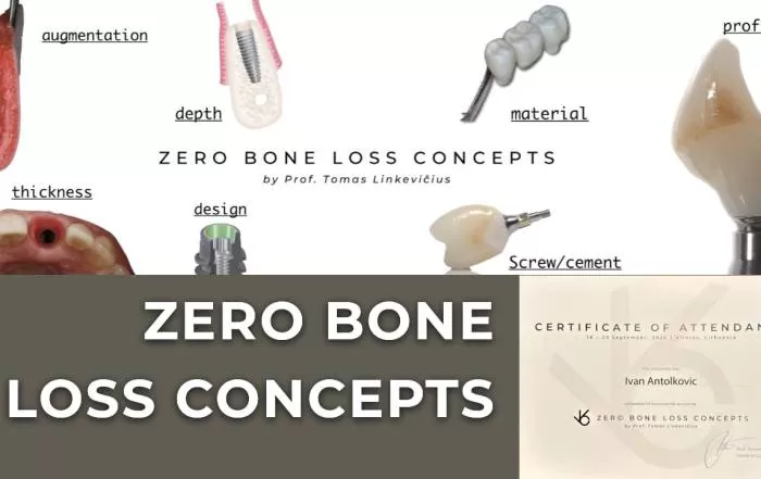 zero-bone-loss-concepts-novi-standard-u-implantologiji