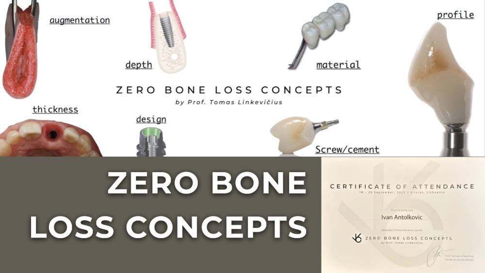 zero-bone-loss-concepts-novi-standard-u-implantologiji zero-bone-loss-concepts-novi-standard-u-implantologiji