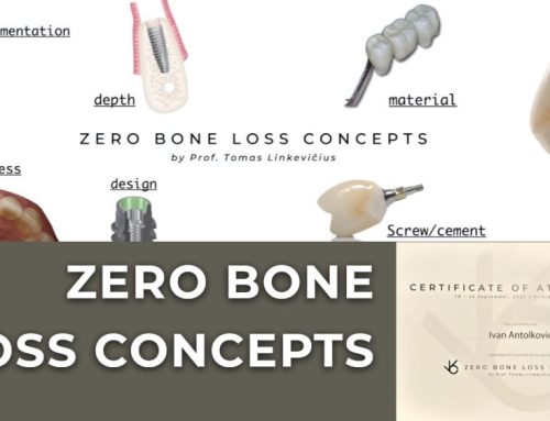 Zero Bone Loss Concepts: A new standard in implantology