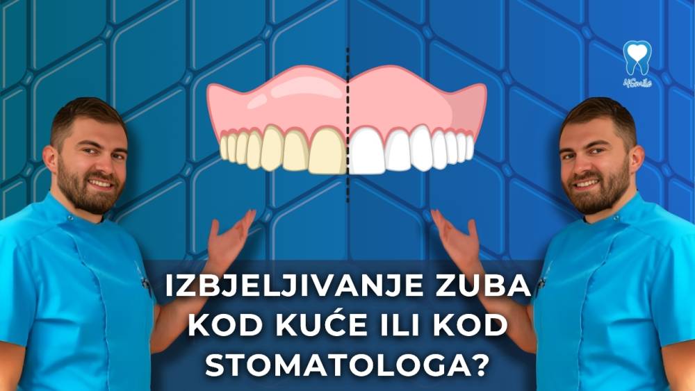 izbjeljivanje-zuba-kod-kuce-ili-kod-stomatologa-kratki-video-blog izbjeljivanje-zuba-kod-kuce-ili-kod-stomatologa-kratki-video-blog