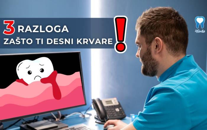 krvare-li-vam-desni-kratki-video-blog